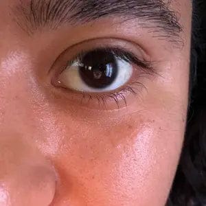 Customer photo review of Vitamin C Glutathione Booster Shot SkinSerum