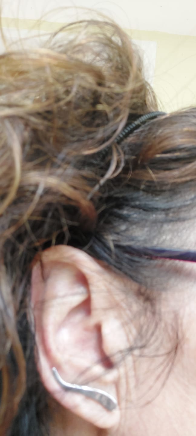 Customer photo review of Rise Ear Climber
