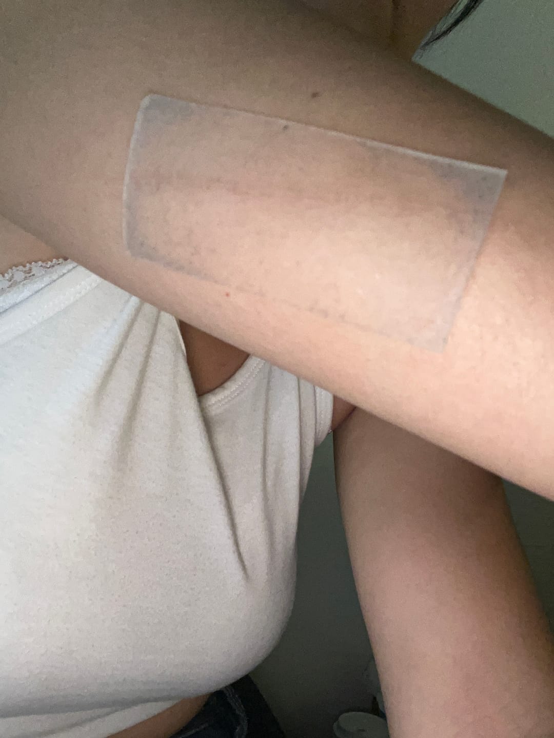 Customer photo review of Epi-Derm C-Strip