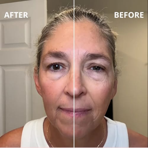 Customer photo review of The Lymphatic Contour Face Brush