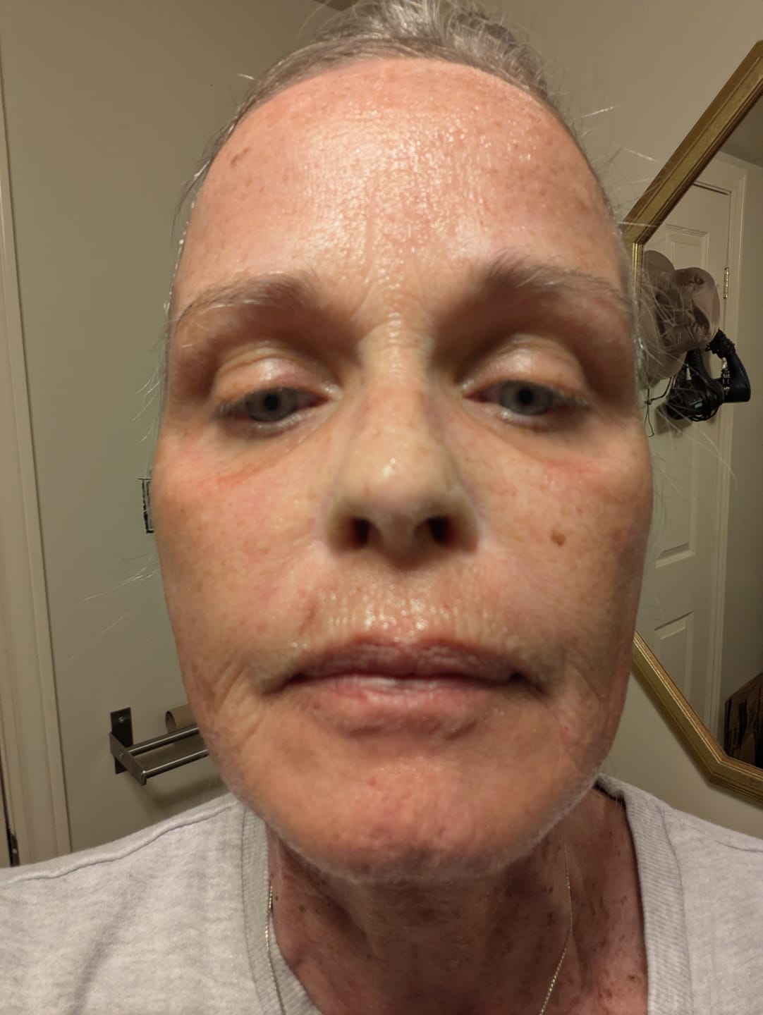 Customer photo review of Collagen Mask