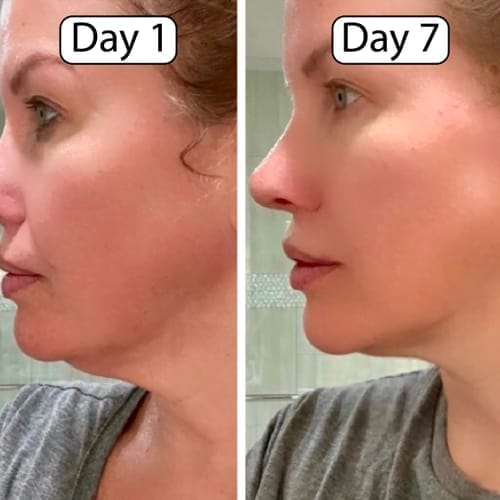 Customer photo review of The Lymphatic Contour Face Brush