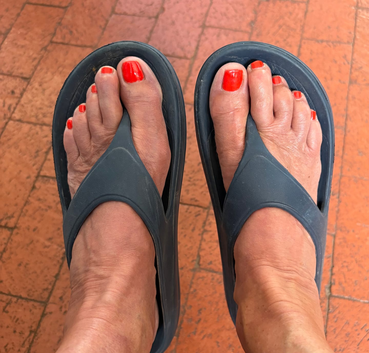 Customer photo review of Ergonomic Flip Flop with Arch Support