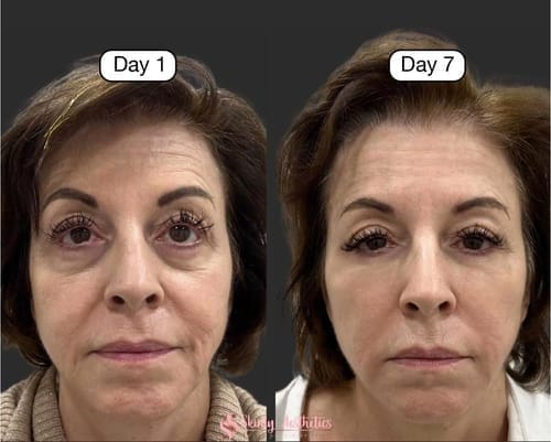 Customer photo review of The Lymphatic Contour Face Brush