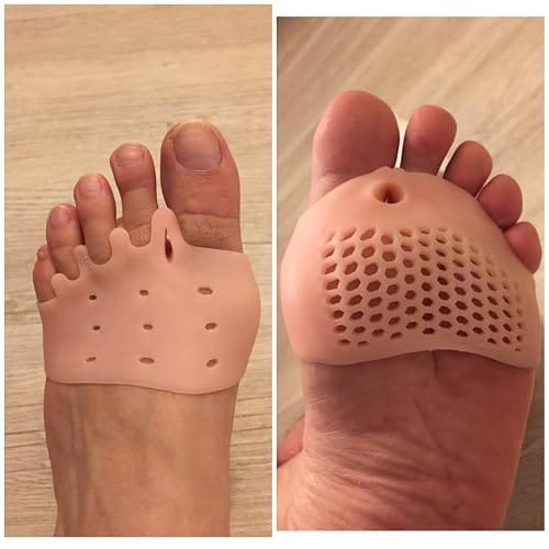 Customer photo review of Mesorto™ Parmak Ayırıcı