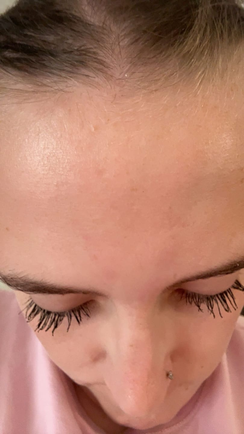 Customer photo review of The Lash Rehab Duo