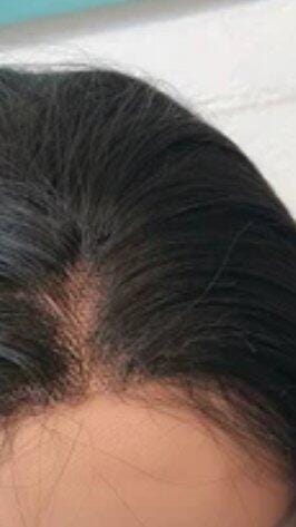 Customer photo review of ¿Poco cabello o poco volumen en la parte superior?