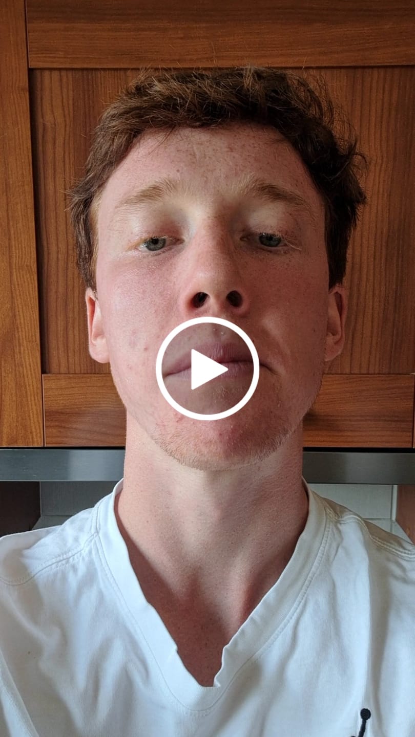 Customer video review of JAWLINER® 3.0 - Advanced