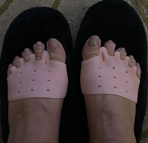 Customer photo review of Mesorto™ Parmak Ayırıcı
