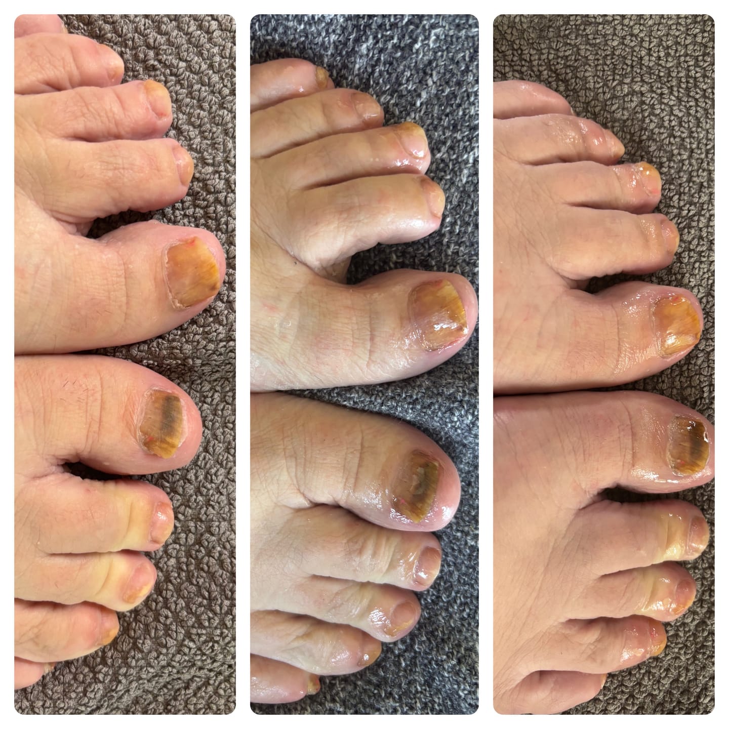 Customer photo review of Fungal Freedom