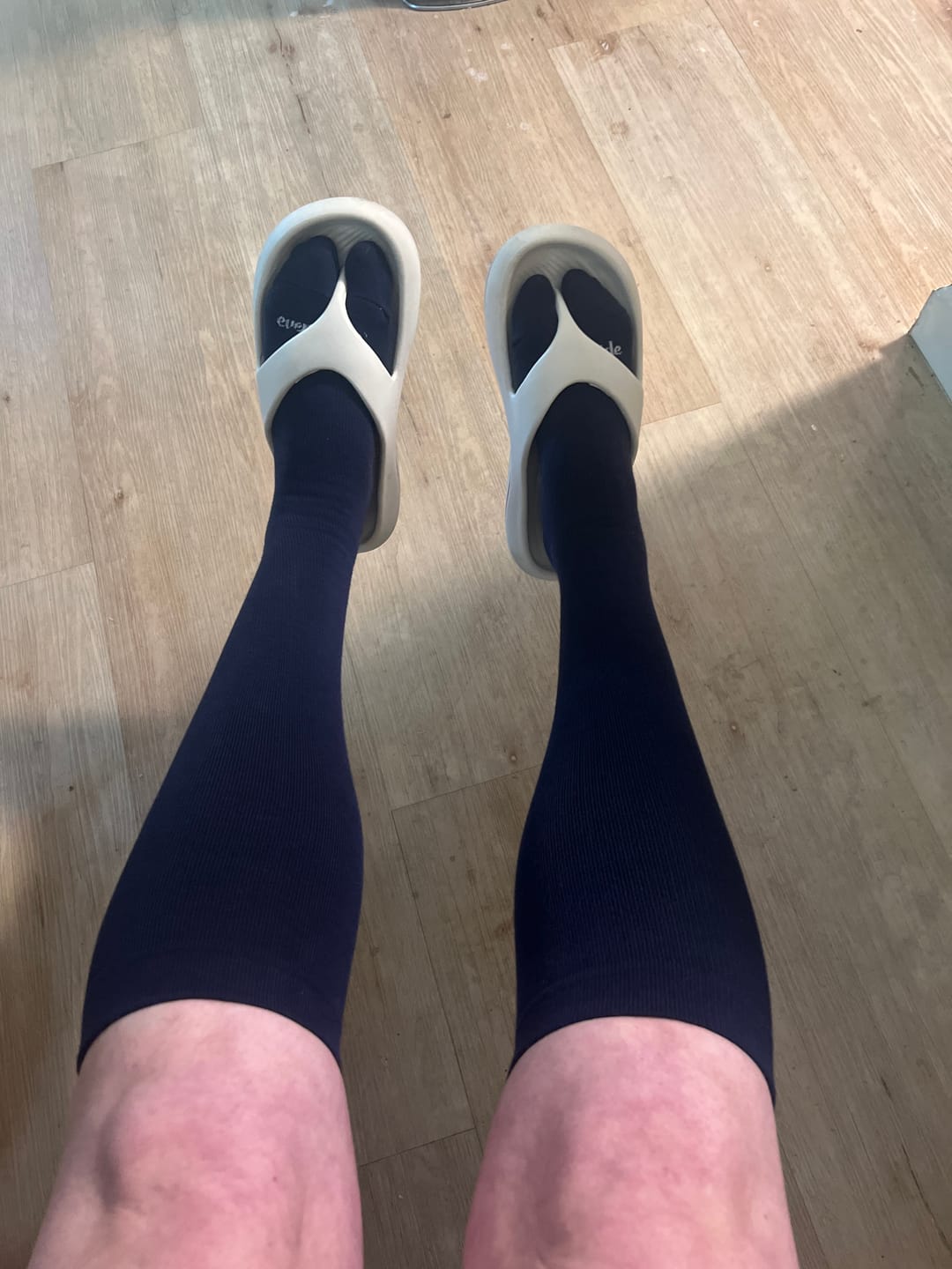 Customer photo review of Bamboo Wide Compression Socks