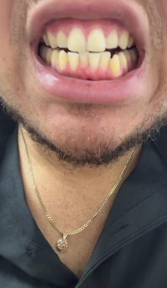Customer photo review of Enjuague Resplandor Dental