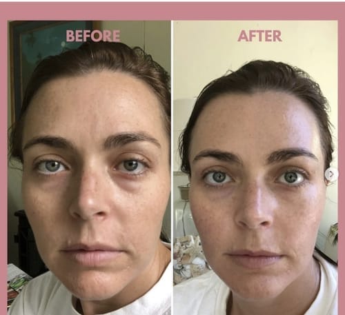 Customer photo review of The Lymphatic Contour Face Brush