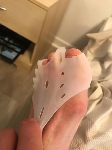 Customer photo review of Mesorto™ Parmak Ayırıcı