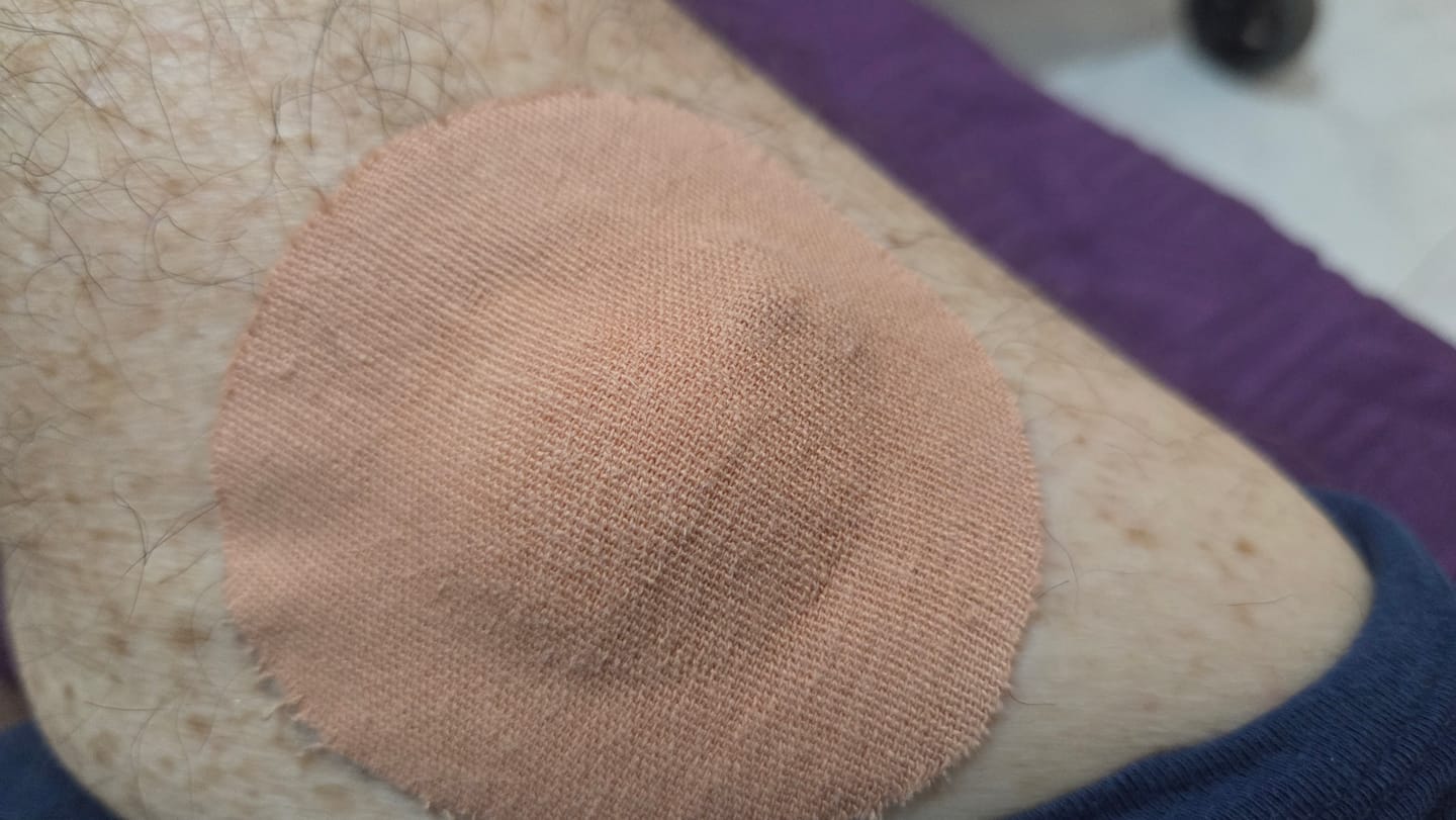 Customer photo review of Original Patch גוף 20 יח׳