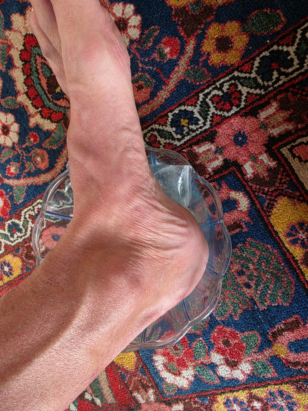 Customer photo review of Einlegesohlen gegen Plantarfasziitis | Foamr®