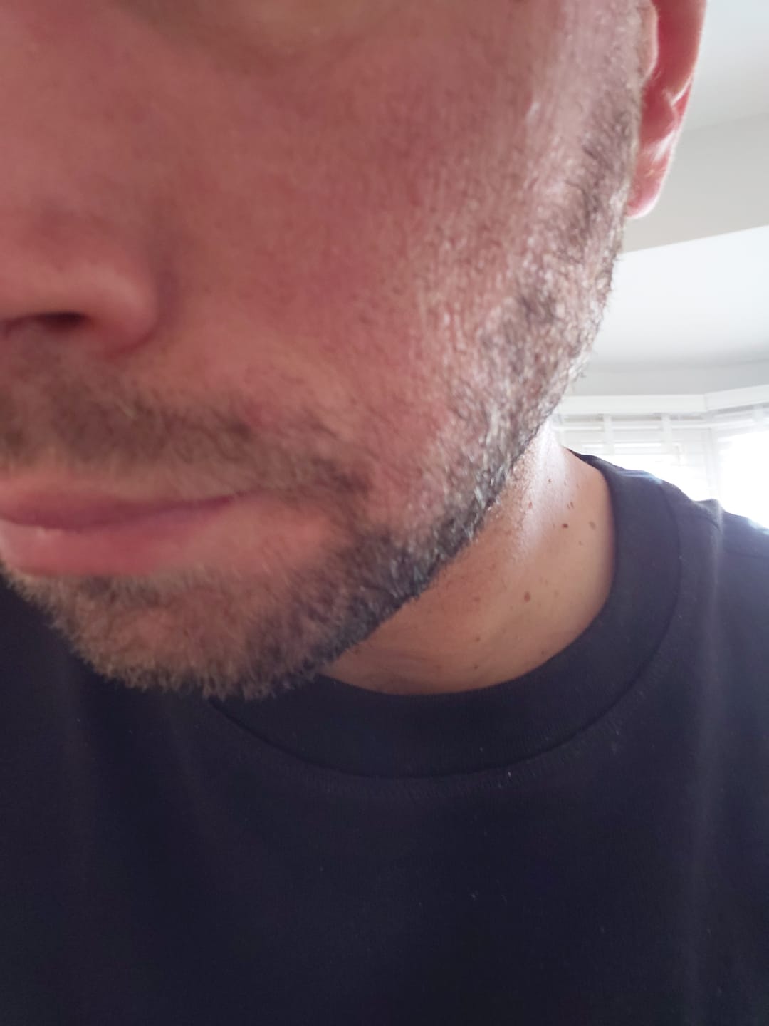 Customer photo review of Seb Natural Calming Serum