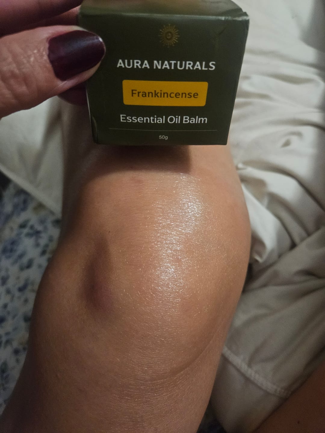 Customer photo review of Frankincense Balm
