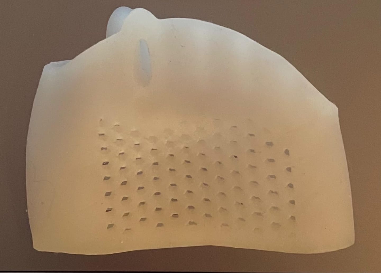 Customer photo review of Mesorto™ Parmak Ayırıcı