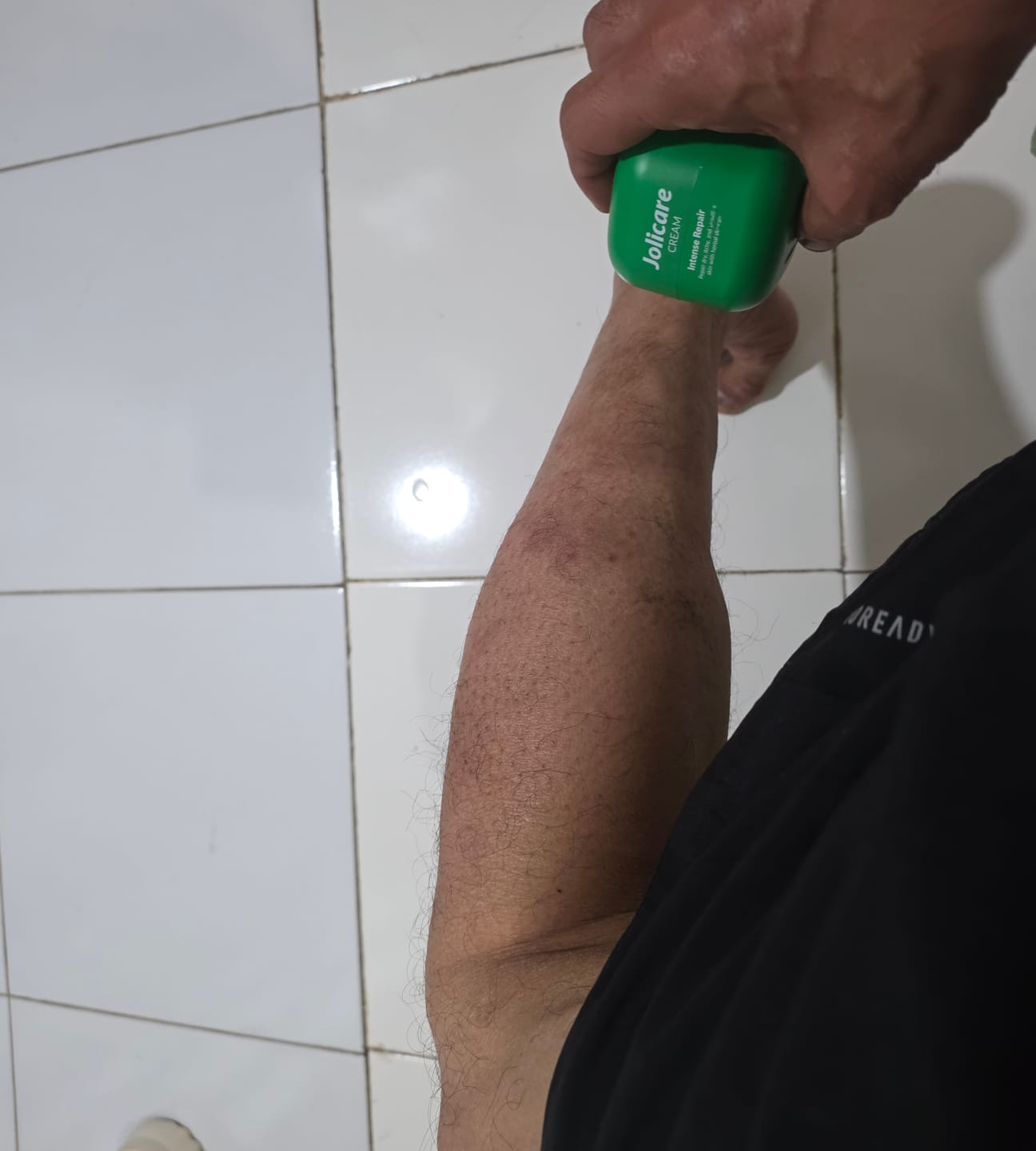 Customer photo review of Jolicare Cream