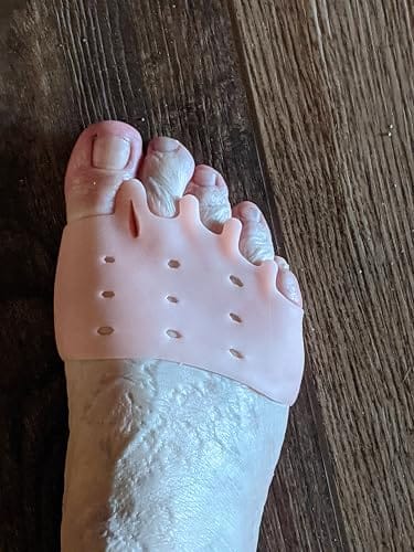 Customer photo review of Mesorto™ Parmak Ayırıcı