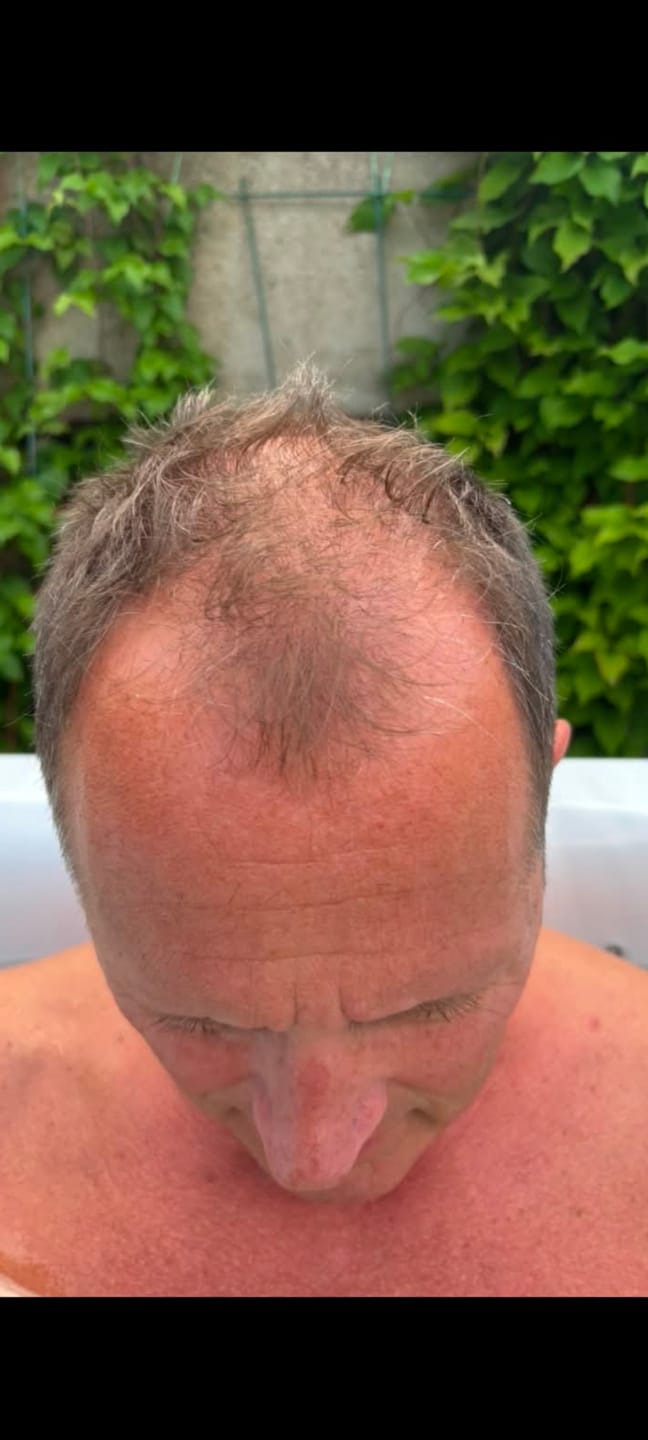 Customer photo review of SHAMPOING NATUREL AU ROMARIN ET À LA KÉRATINE — POUR DES CHEVEUX PLUS ÉPAIS ET PLUS VOLUMINEUX