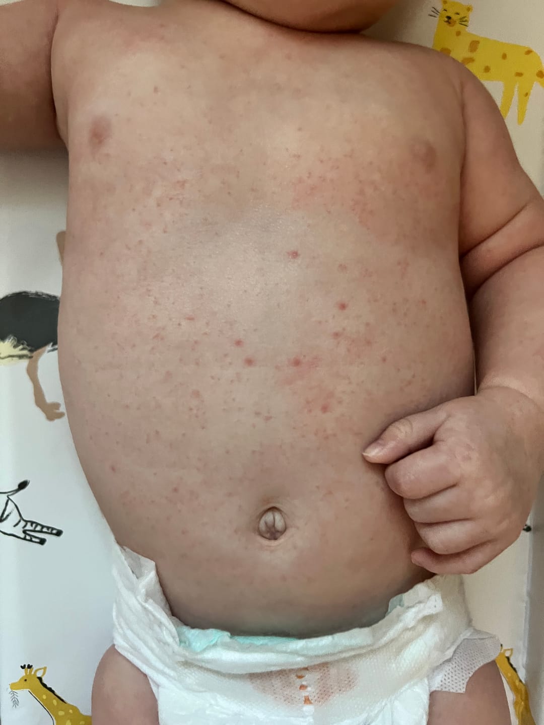 Customer photo review of Large Bioskin Junior Duo Pack