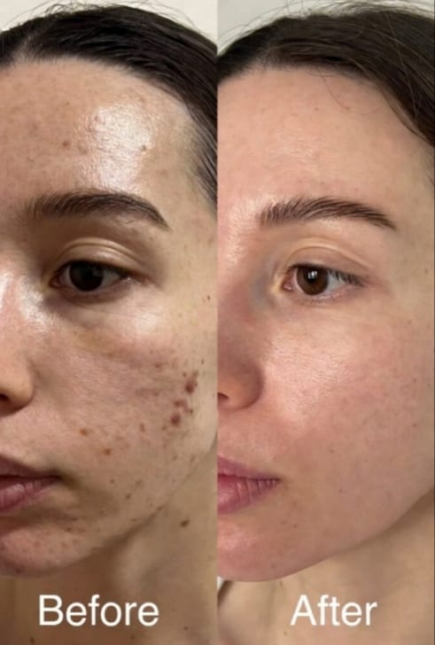 Customer photo review of Maxdif Facewash