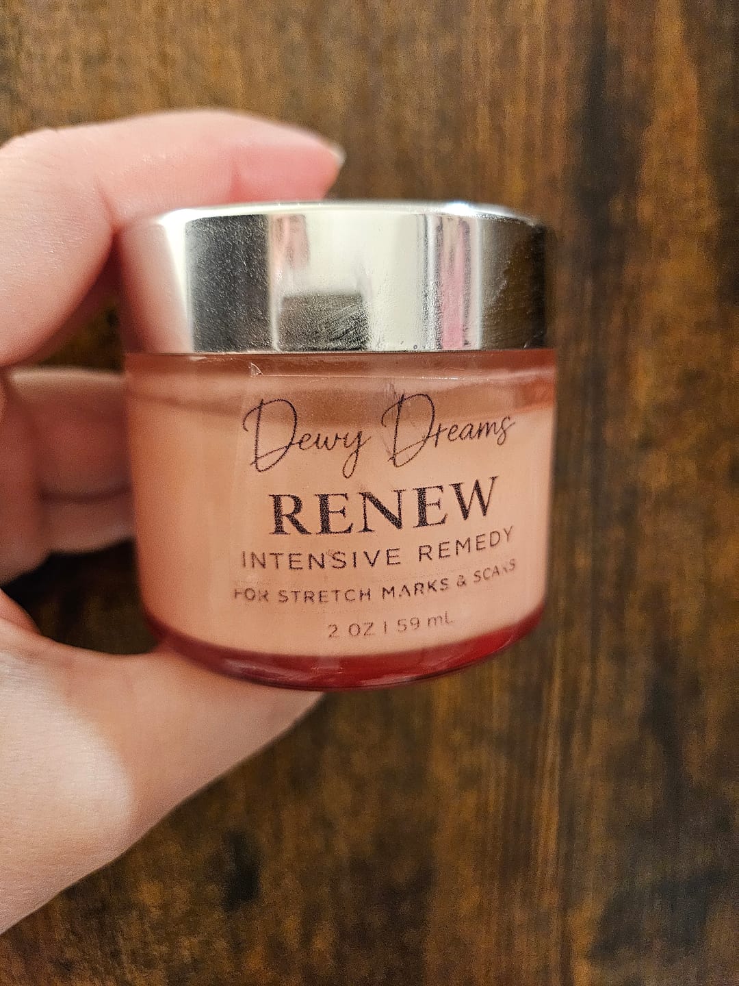 Customer photo review of Renew Intensive Remedy for Stretch Marks and Scars