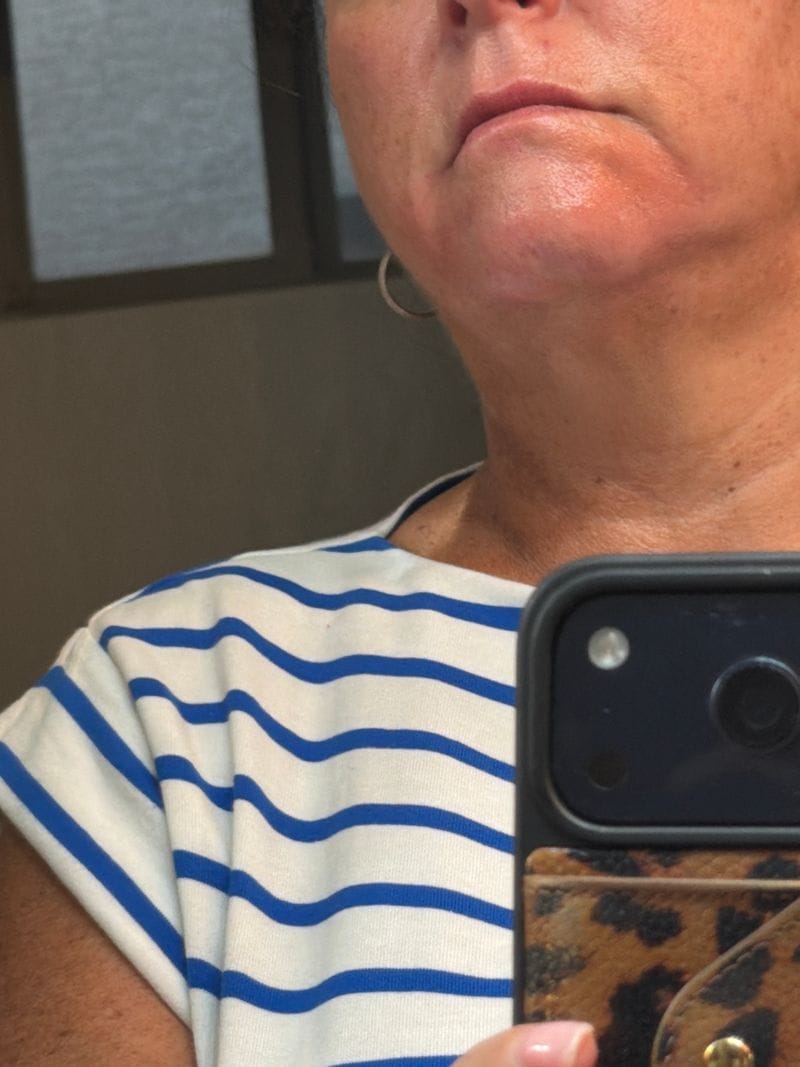 Customer photo review of Aceite botánico anti-crecimiento | Alternativa natural a los láseres