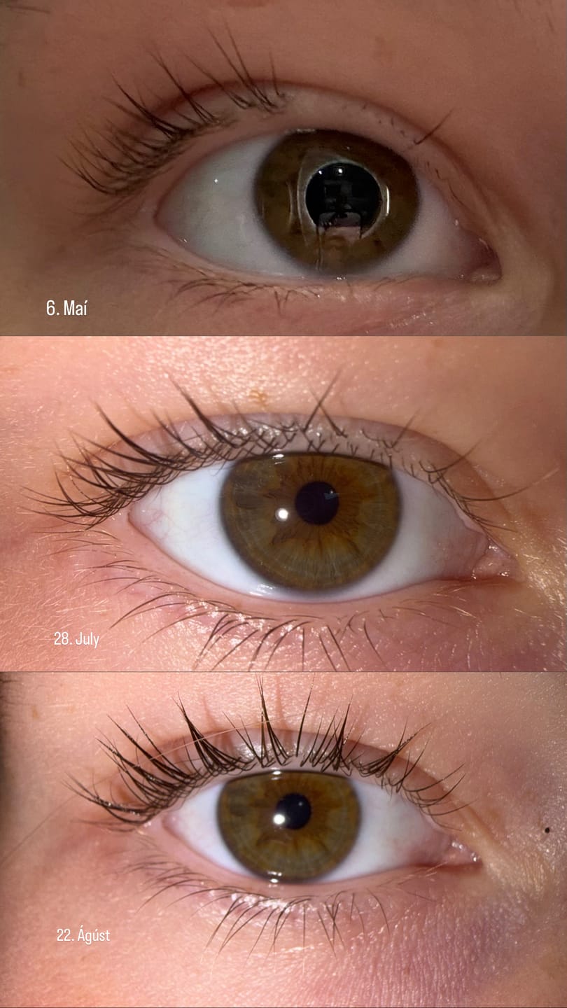 Customer photo review of Lash Serum | INTENSE