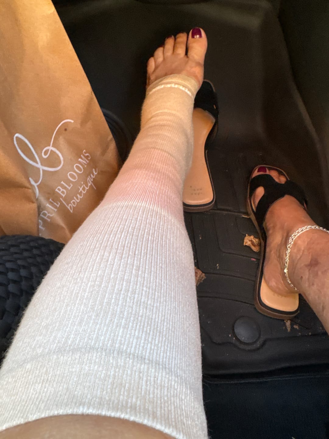 Customer photo review of Toeless Bamboo Wide Compression Socks