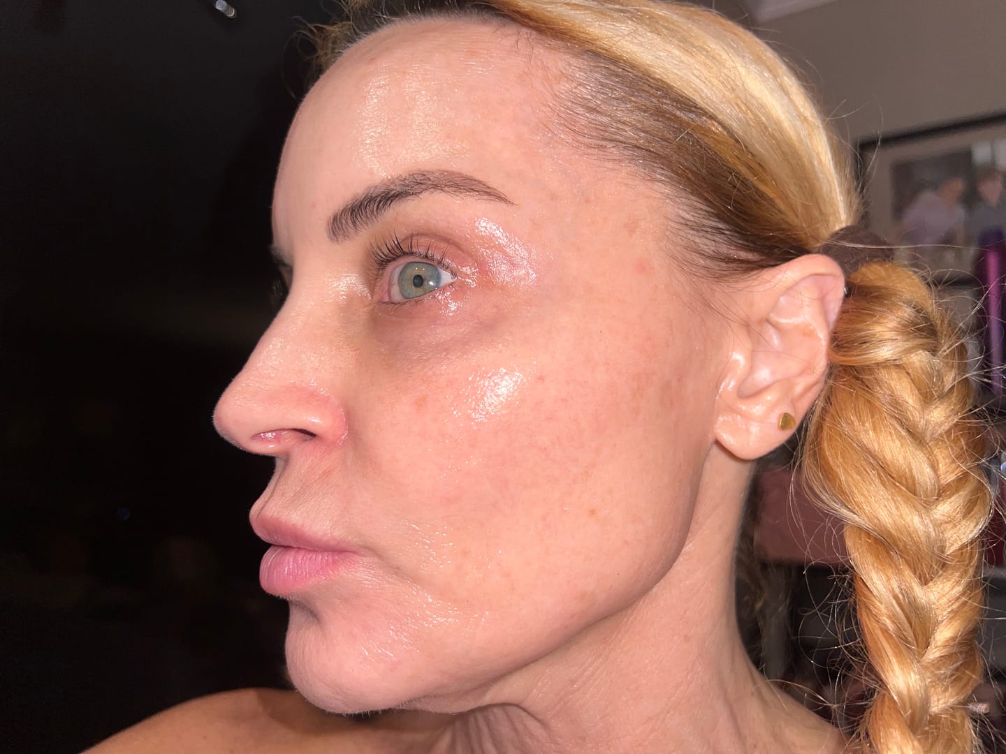 Customer photo review of HEDO Signature Peel with Care Kit