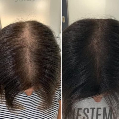 Customer photo review of Savon Capillaire Anti-Chute & Densité