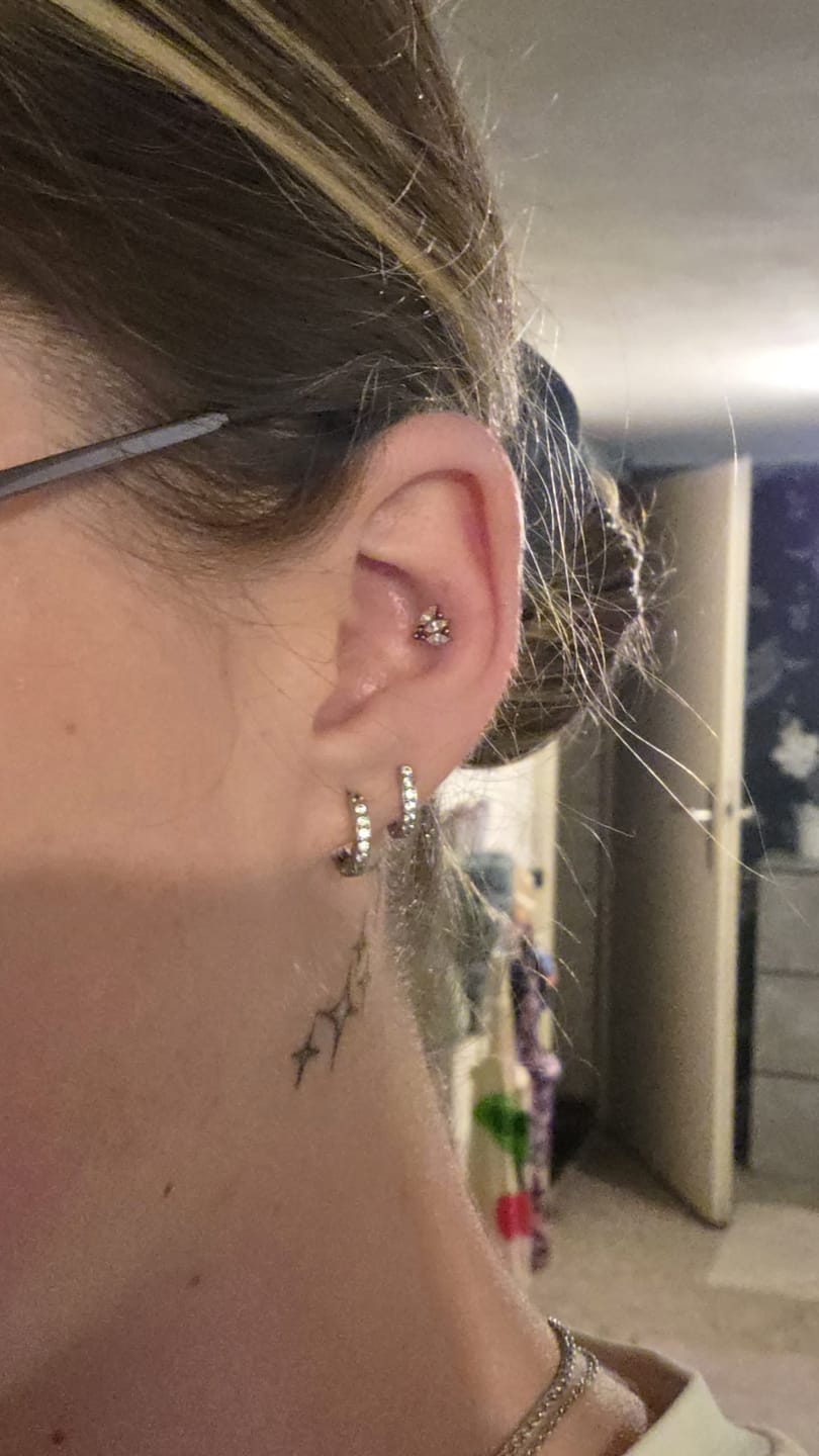 Customer photo review of Trinity Lotus Labret Piercing - Titan