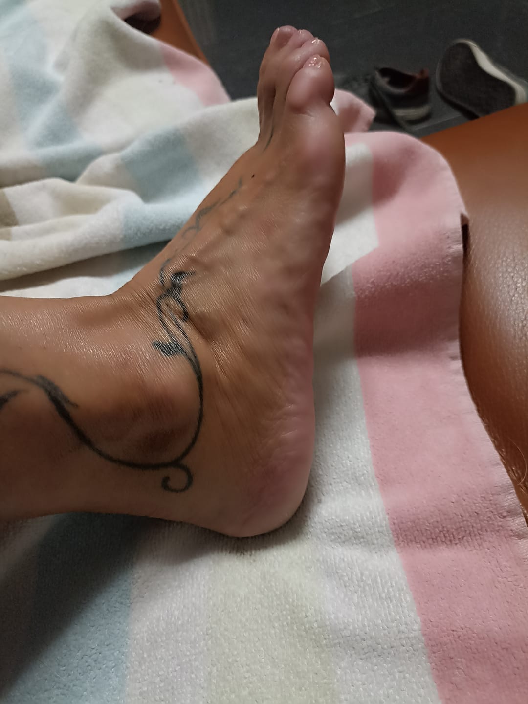 Customer photo review of 🍯 HoneyBalm™ – Baume Hydratant au Miel pour les pieds