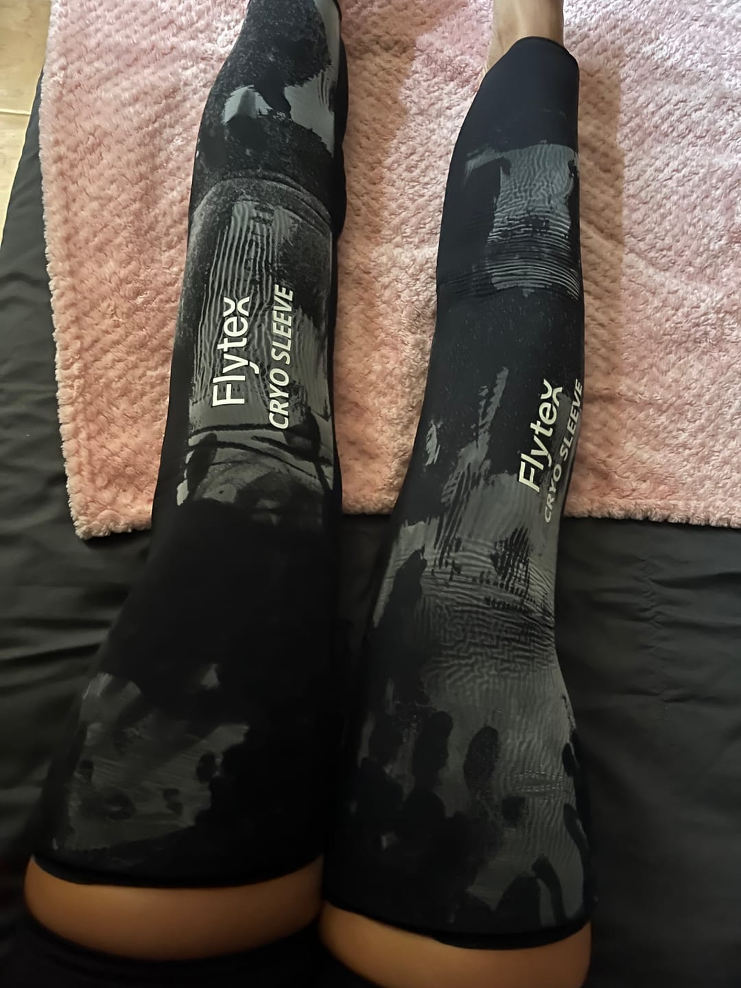 Customer photo review of Manchon de Cryothérapie