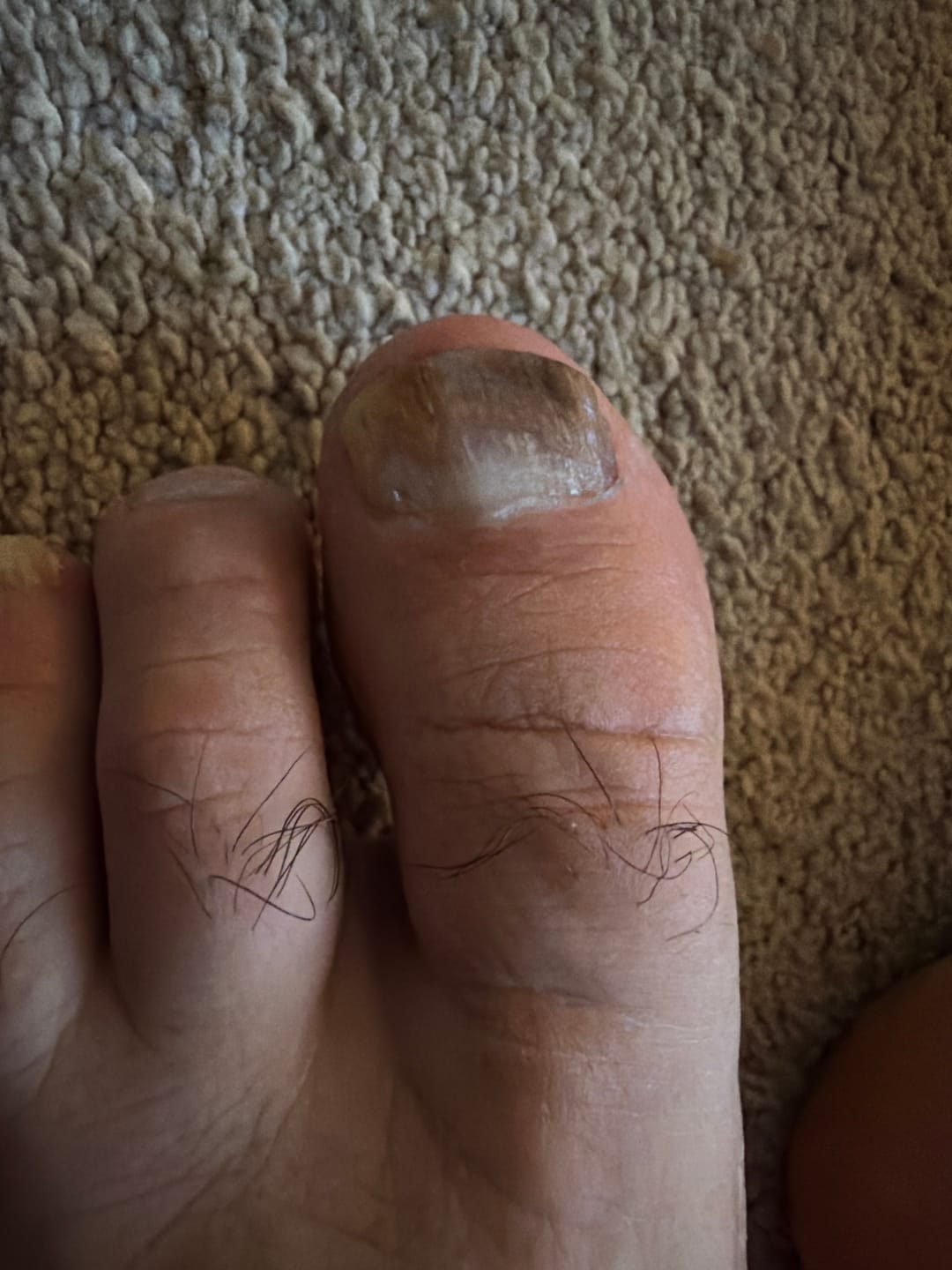 Customer photo review of Fungal Freedom