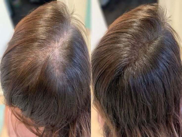 Customer photo review of Savon Capillaire Anti-Chute & Densité