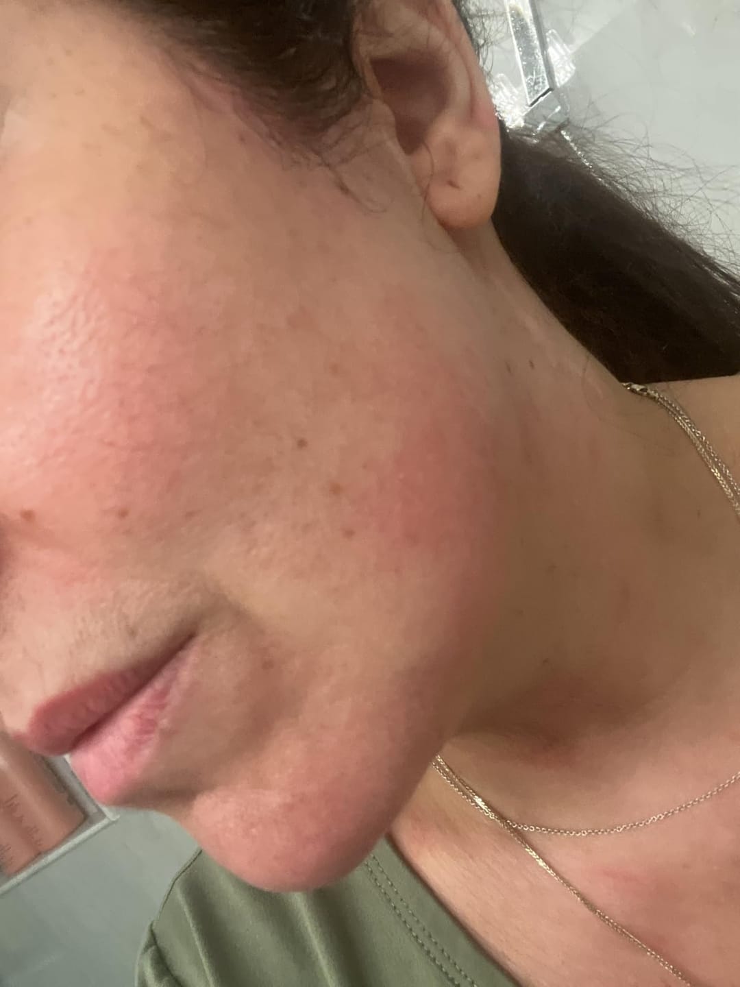 Customer photo review of SparkSmile™ Дълбоко Хидратираща Нощна Маска