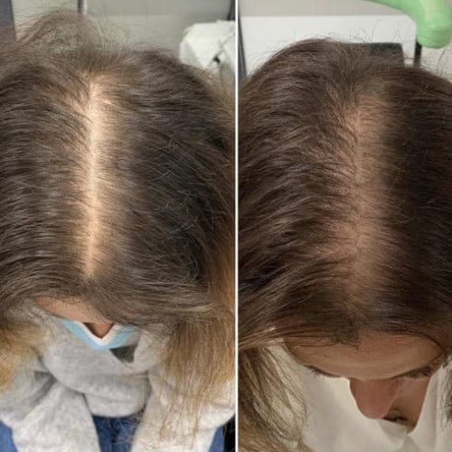 Customer photo review of Savon Capillaire Anti-Chute & Densité