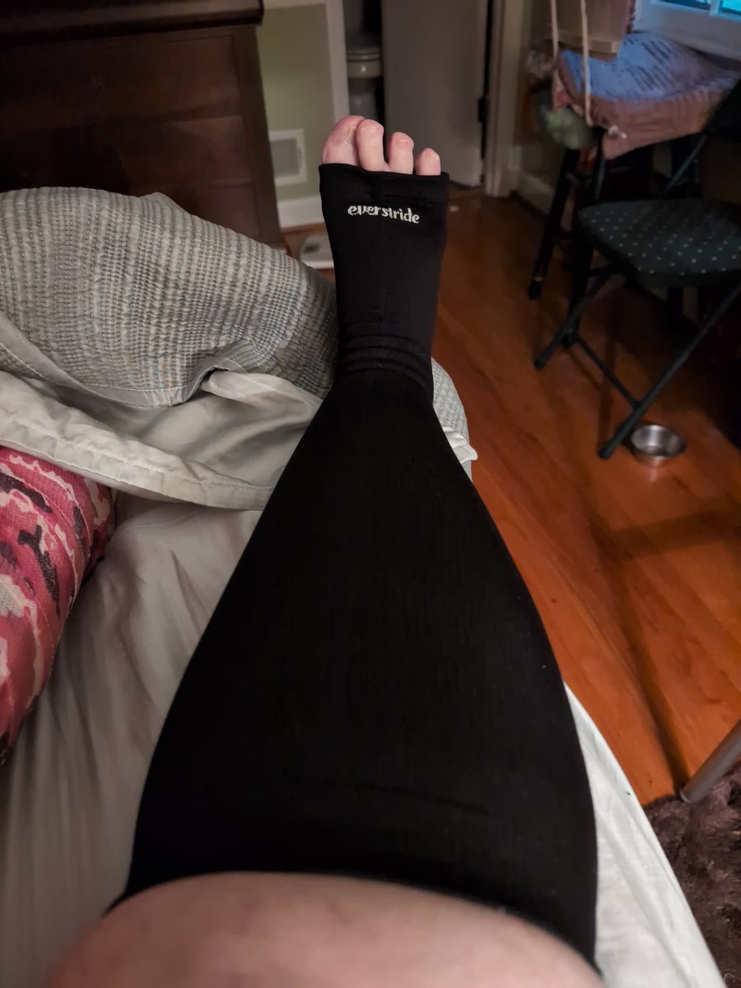 Customer photo review of Toeless Bamboo Wide Compression Socks