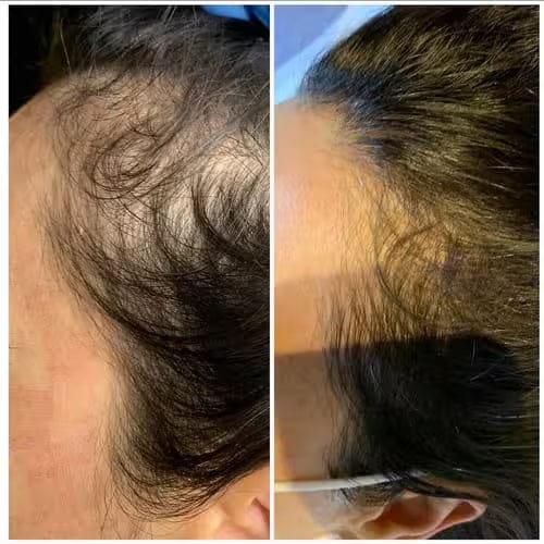 Customer photo review of Savon Capillaire Anti-Chute & Densité