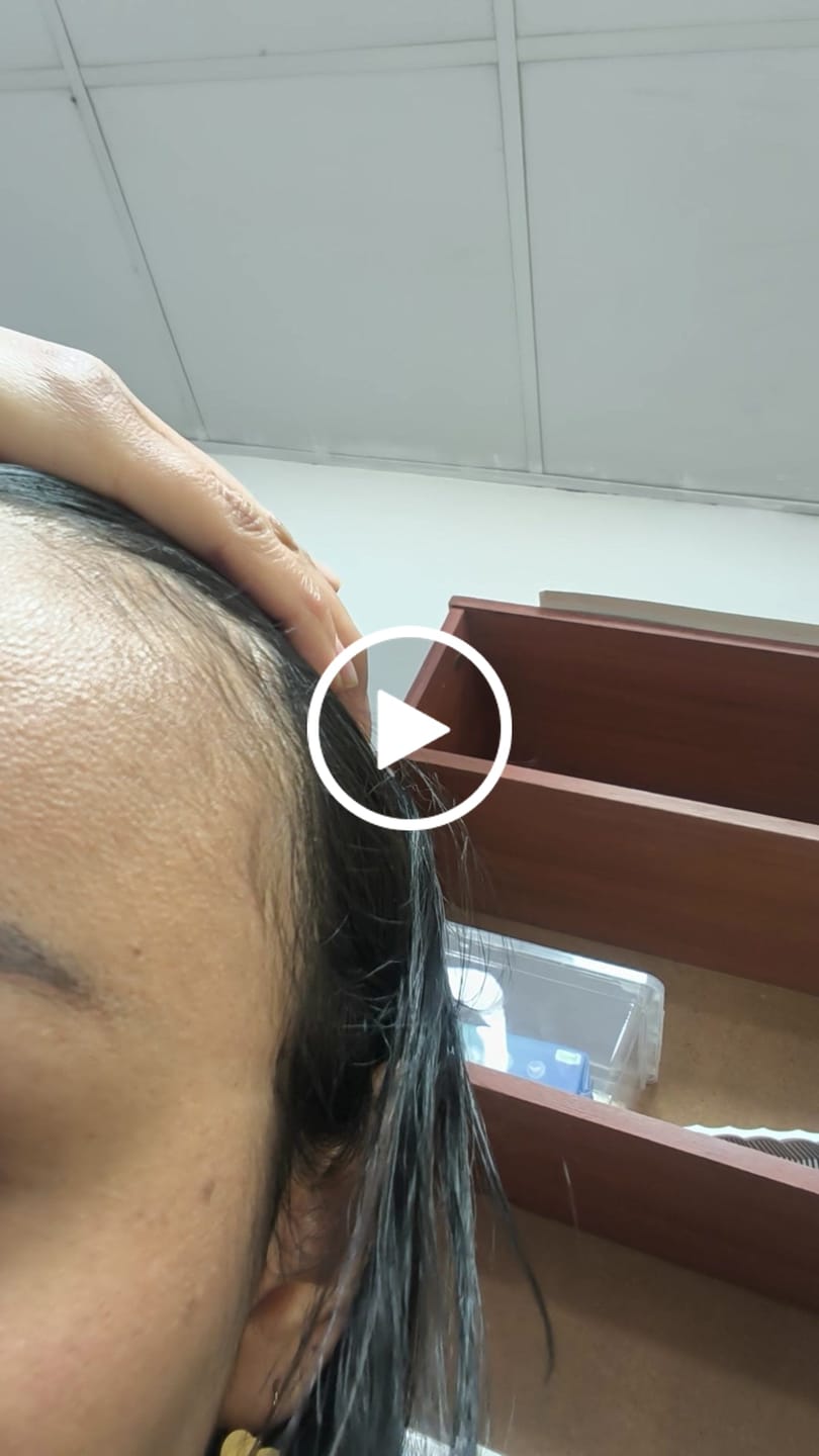 Customer video review of REGALO - Shampoo Control Crecimiento + Desinflamación 30g