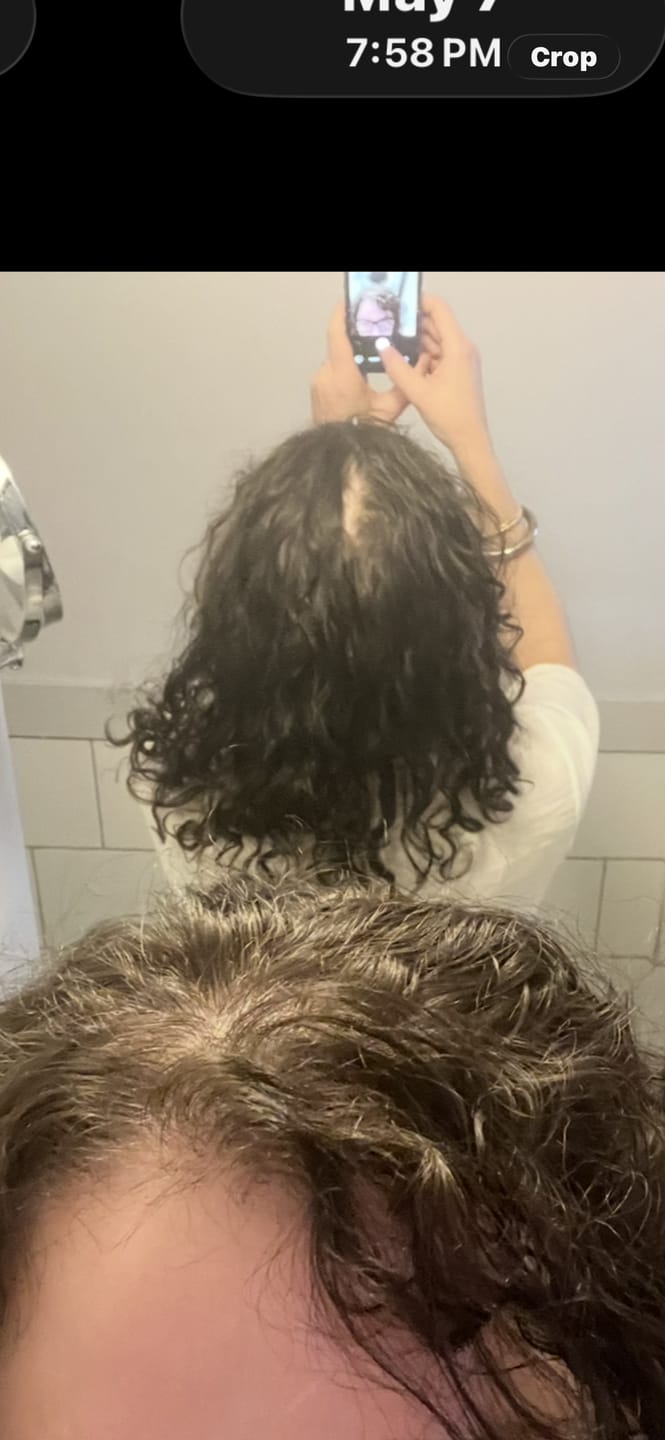 Customer photo review of VITAFOAM ™ Hair Growth Formula