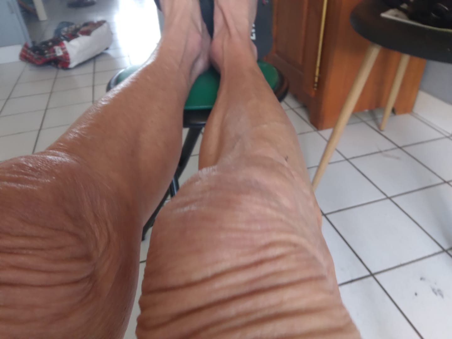 Customer photo review of Huile Liftante Anti-Rides Corps