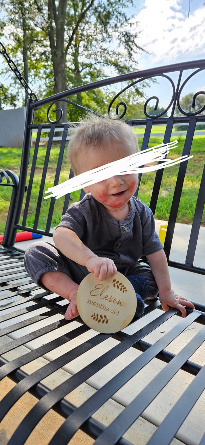 Customer photo review of Healing Salve