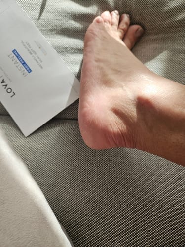 Customer photo review of LOVASKIN Discovery Kit SPECIAL TV OFFER - Twice the treatments
