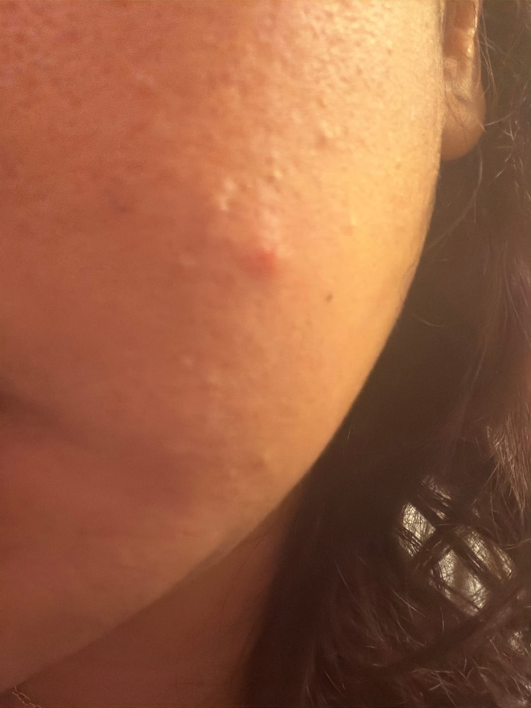 Customer photo review of Healgel Restorative