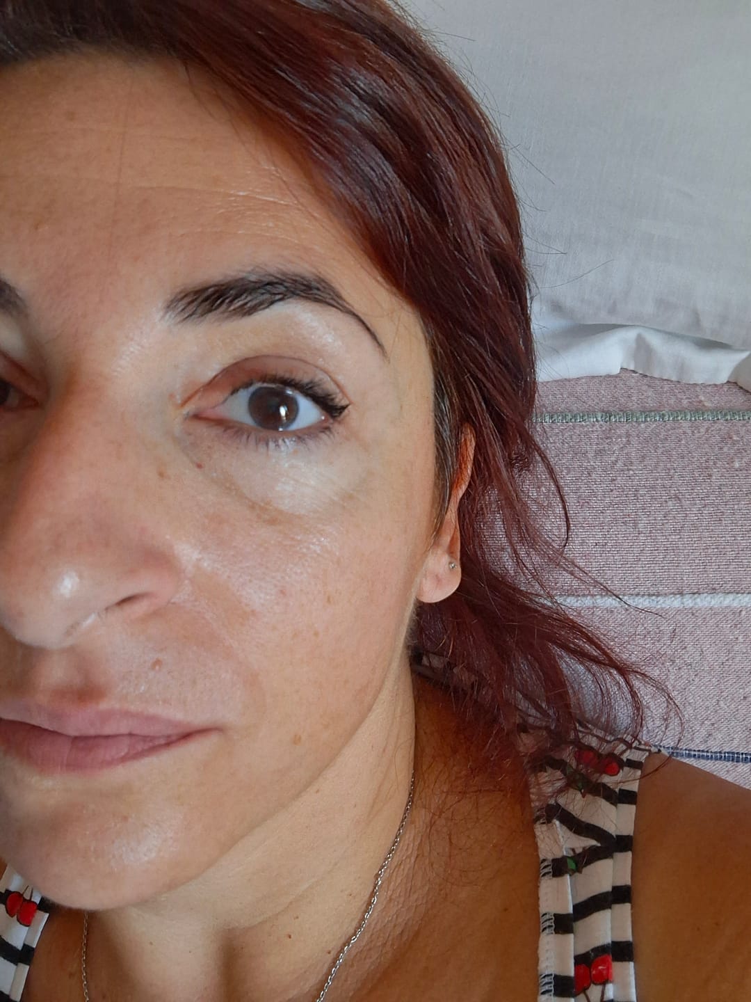 Customer photo review of BioChroma – Siero Coreano Effetto Lifting dalla Prima Applicazione
